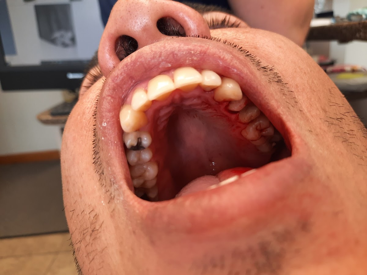 Affordable Dentures & Implants - Checotah photo 4