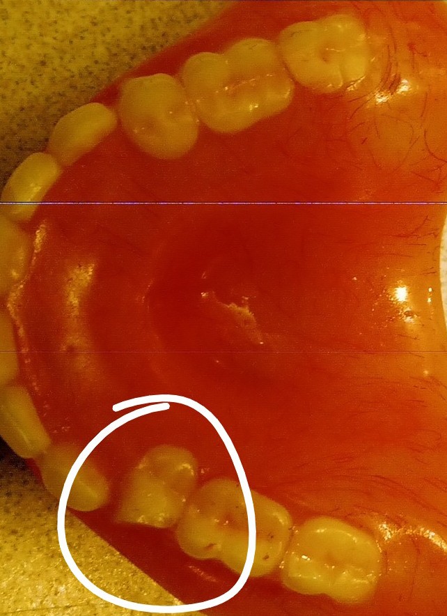 Affordable Dentures & Implants - Checotah photo 6