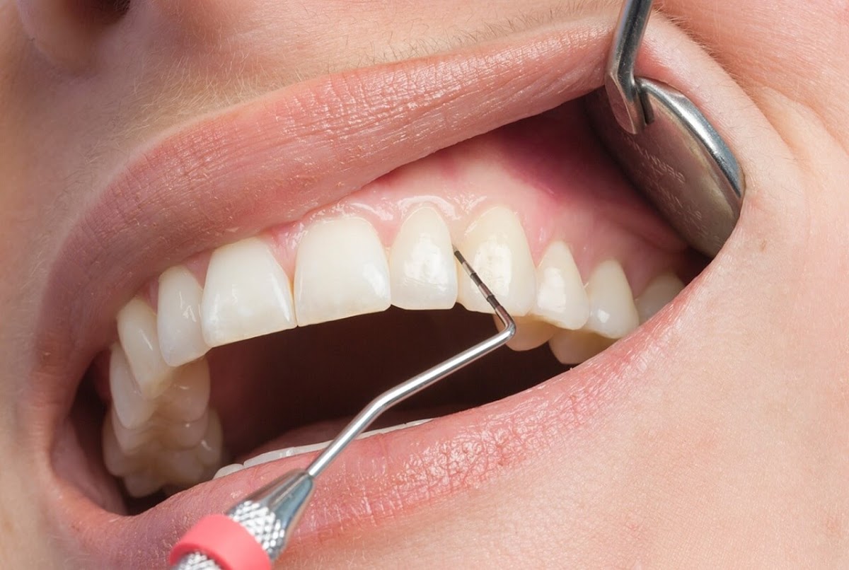 Ukiah Dental | Dr. Richard S. Phillips Dds photo 1