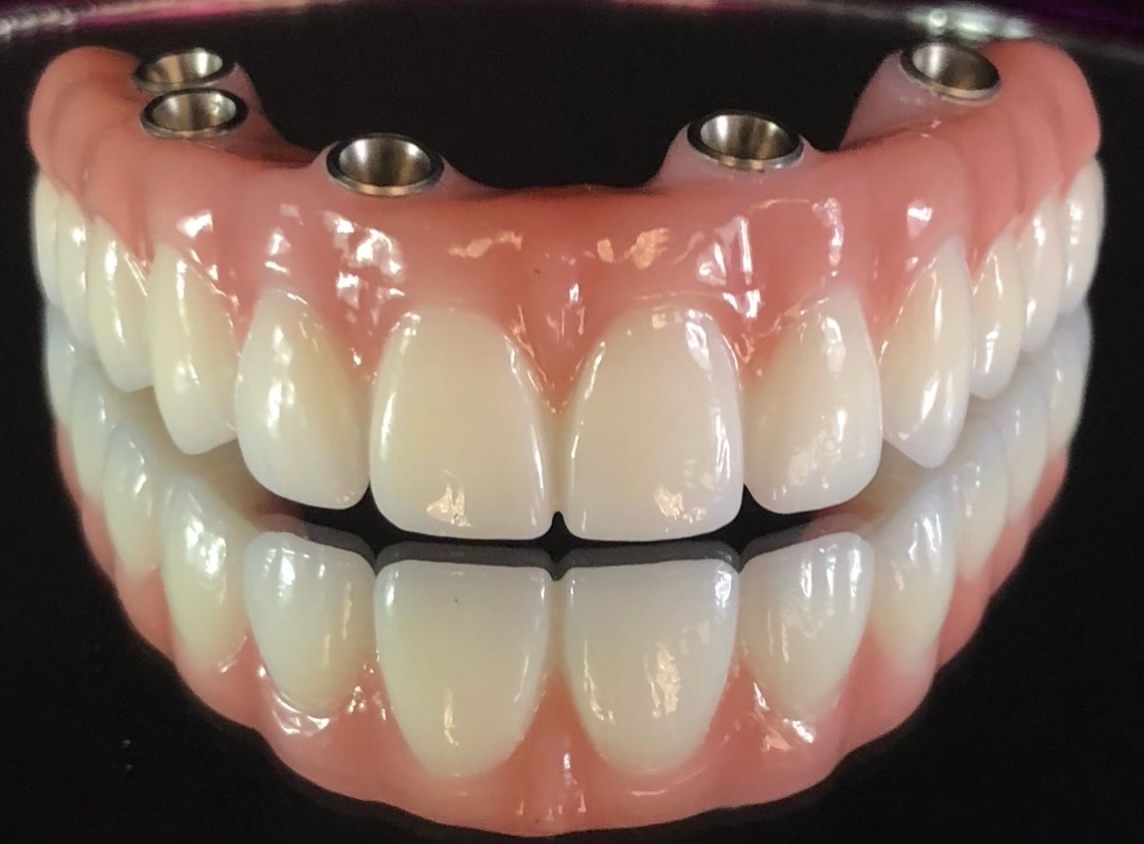 Exceptional Dental Arts photo 1