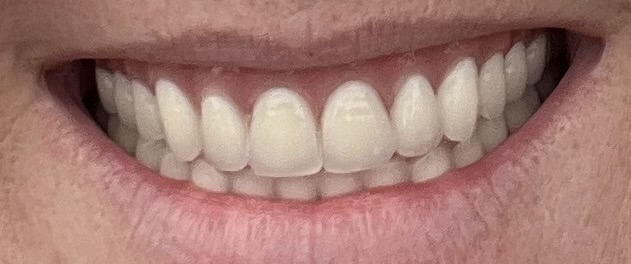 Exceptional Dental Arts photo 2