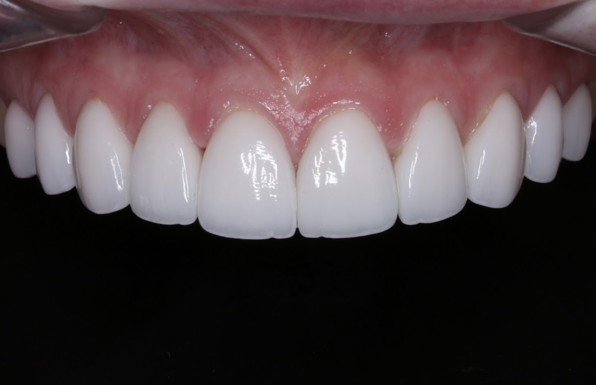 Exceptional Dental Arts photo 4