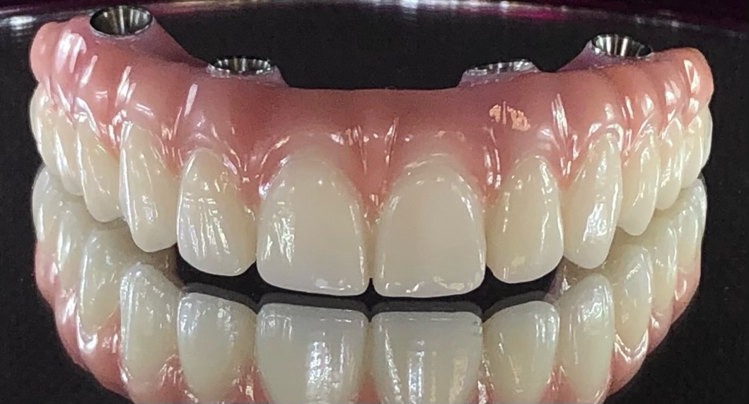 Exceptional Dental Arts photo 5