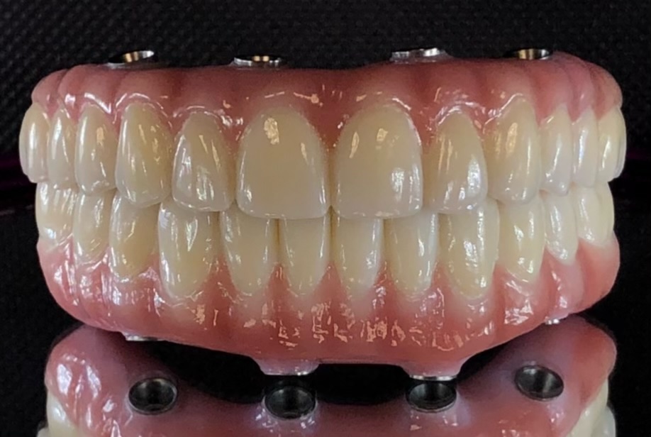 Exceptional Dental Arts photo 6