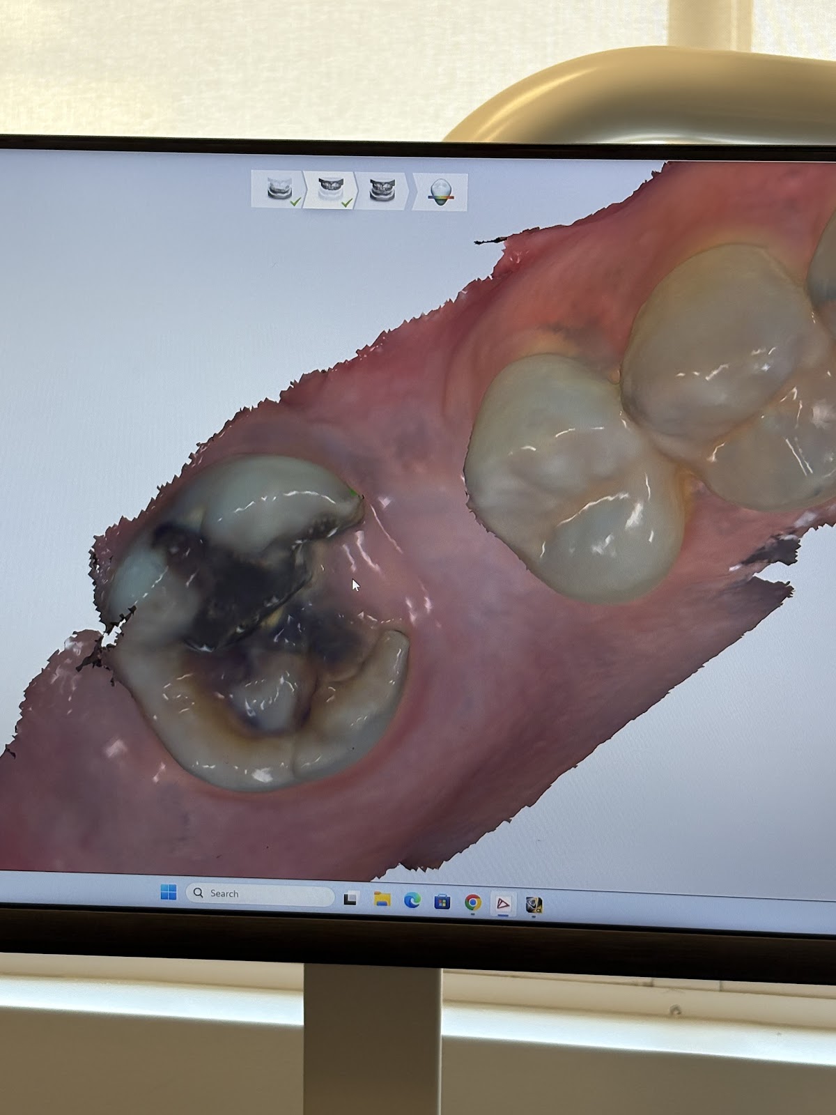 Aspen Dental - Papillion photo 2