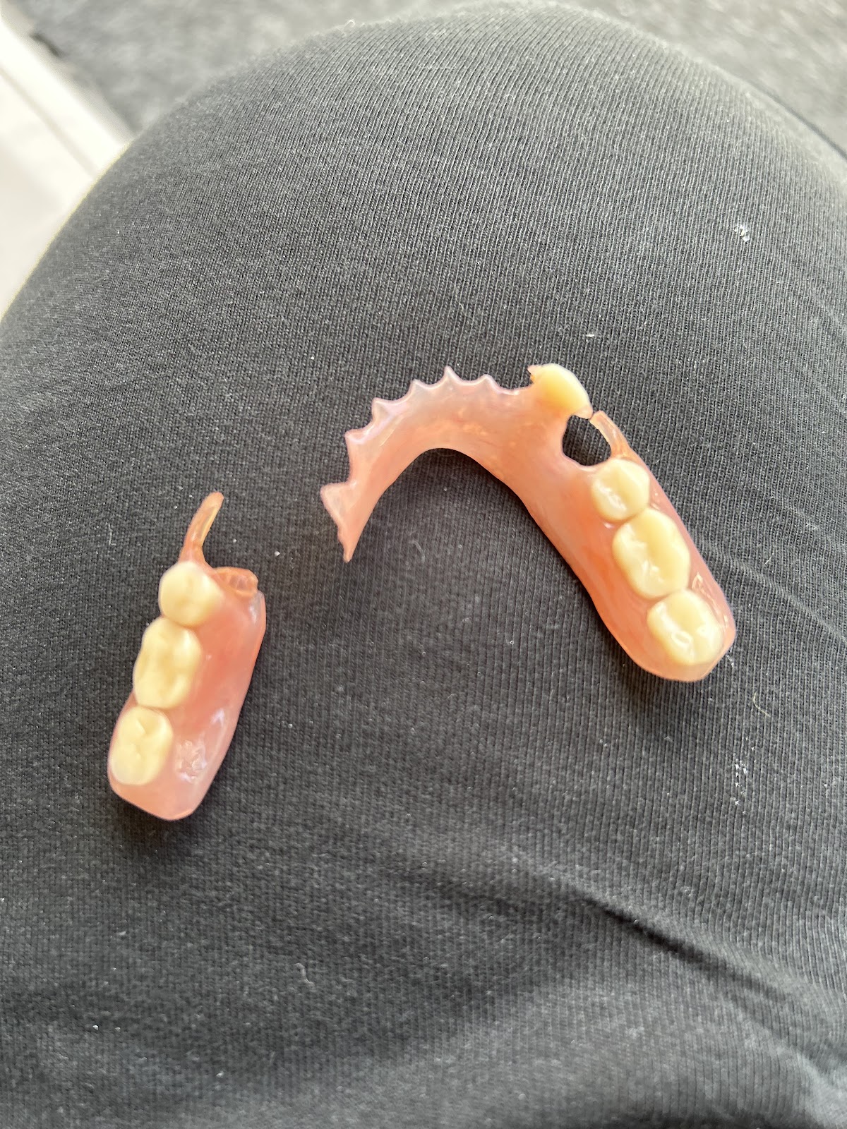 Aspen Dental - Alpharetta photo 4