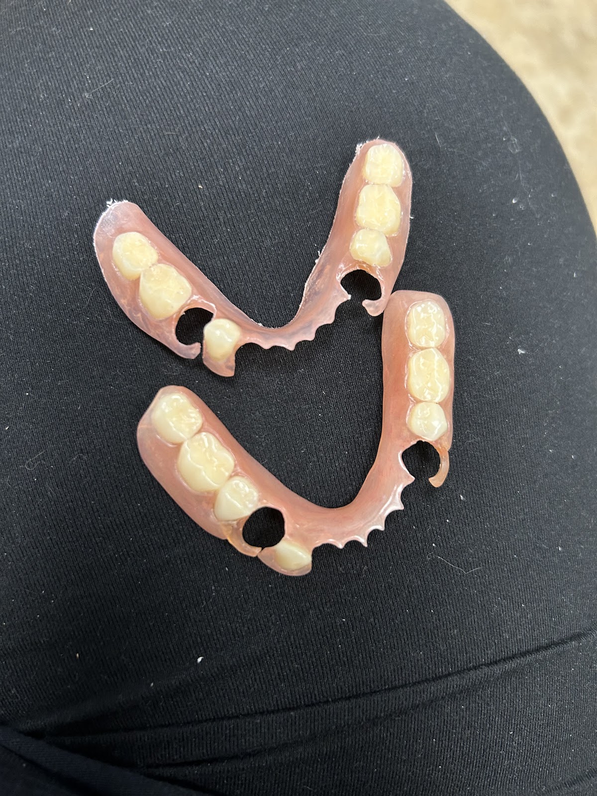 Aspen Dental - Alpharetta photo 6