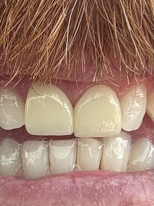 Aspen Dental - Auburn, Me photo 3