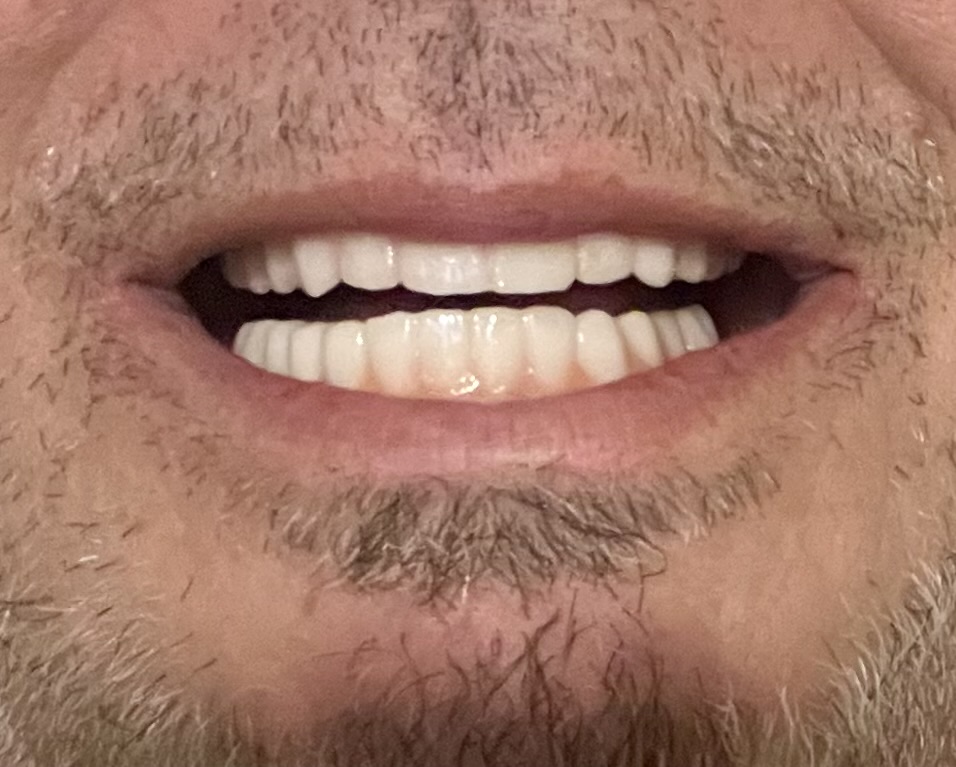 Carolina Implants & Periodontics photo 2