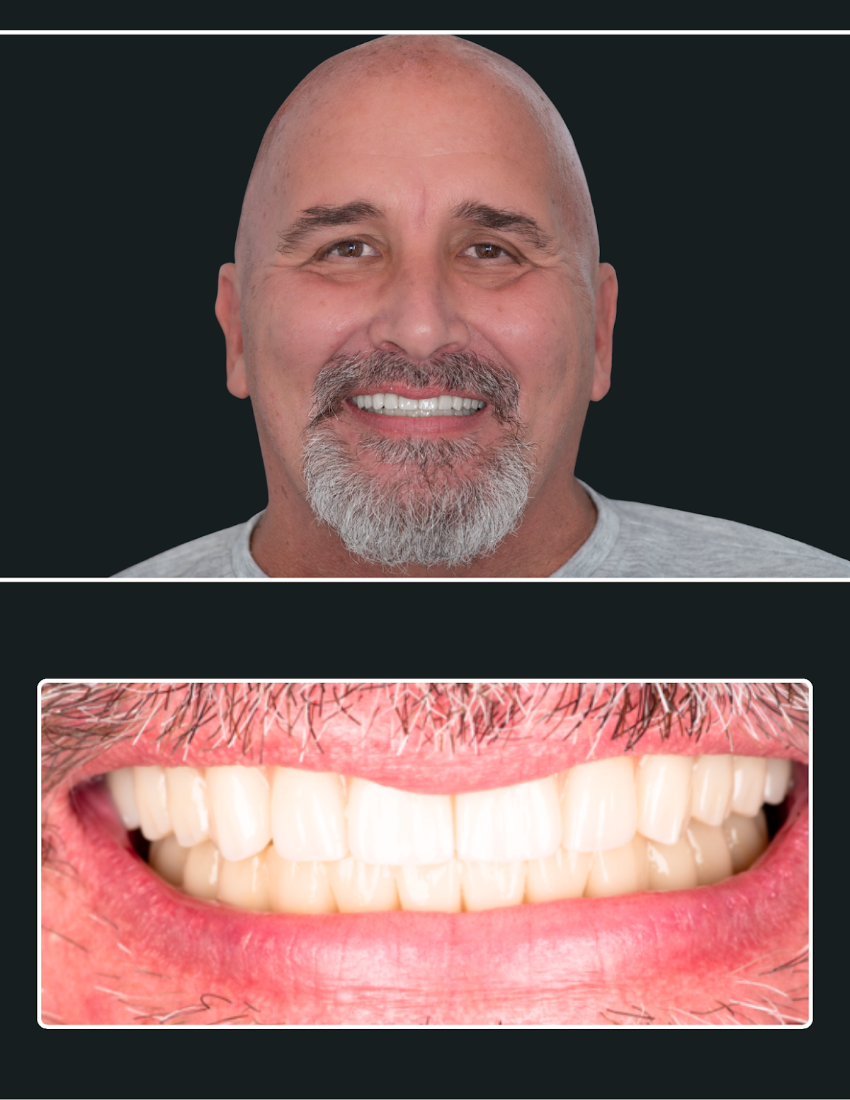 Carolina Implants & Periodontics photo 3