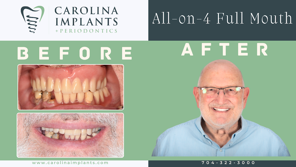 Carolina Implants & Periodontics photo 5