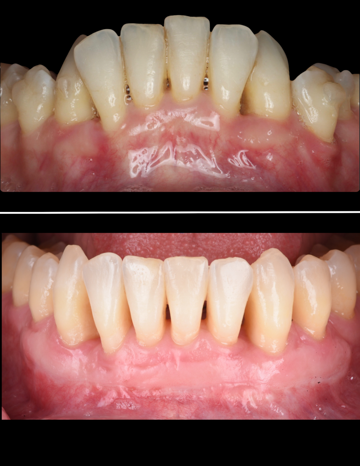 Carolina Implants & Periodontics photo 6