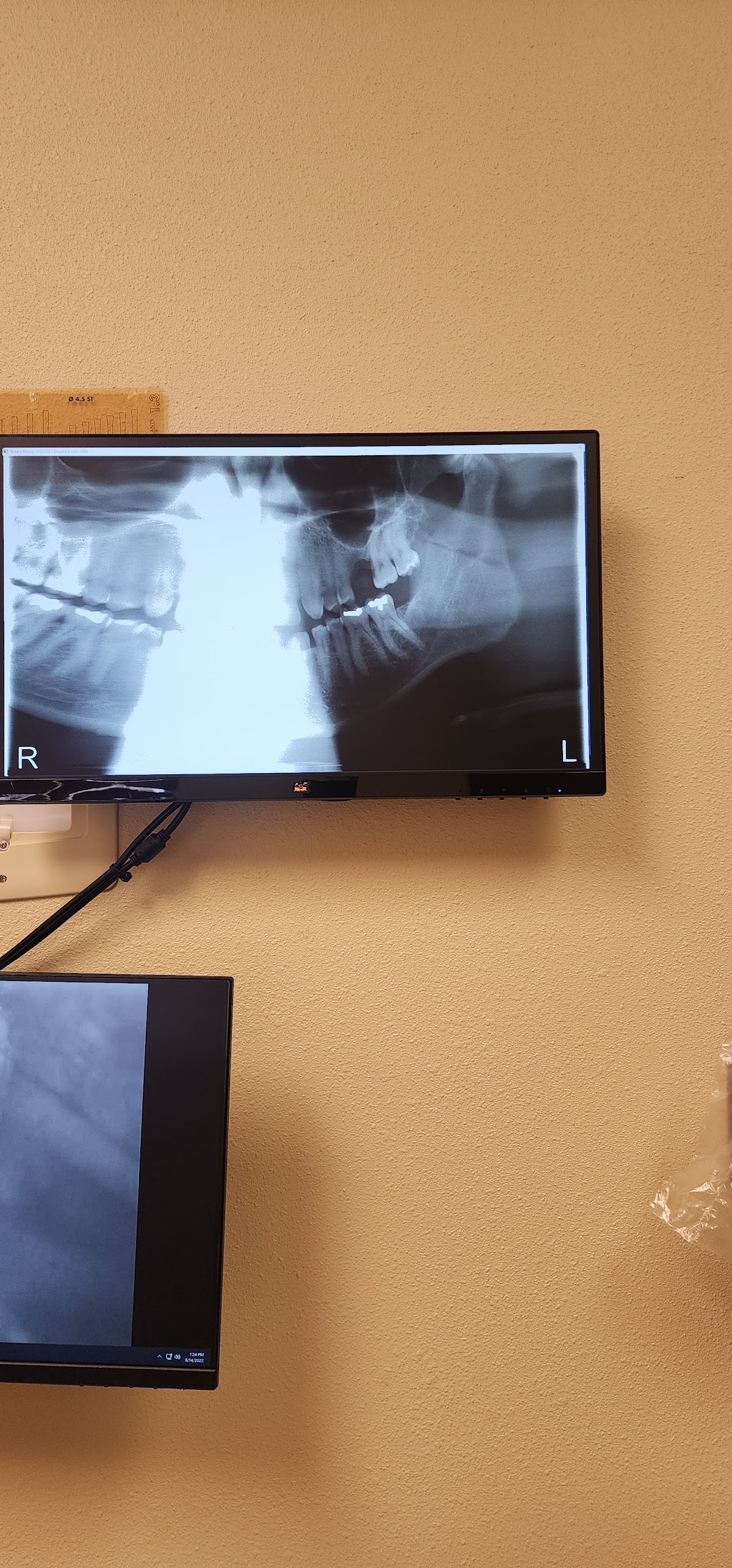 Oral and Maxillofacial Surgery Associates photo 2