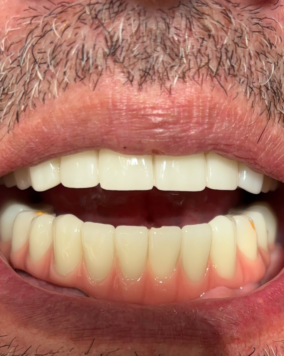 Affordable Dentures & Implants - Mesa photo 2