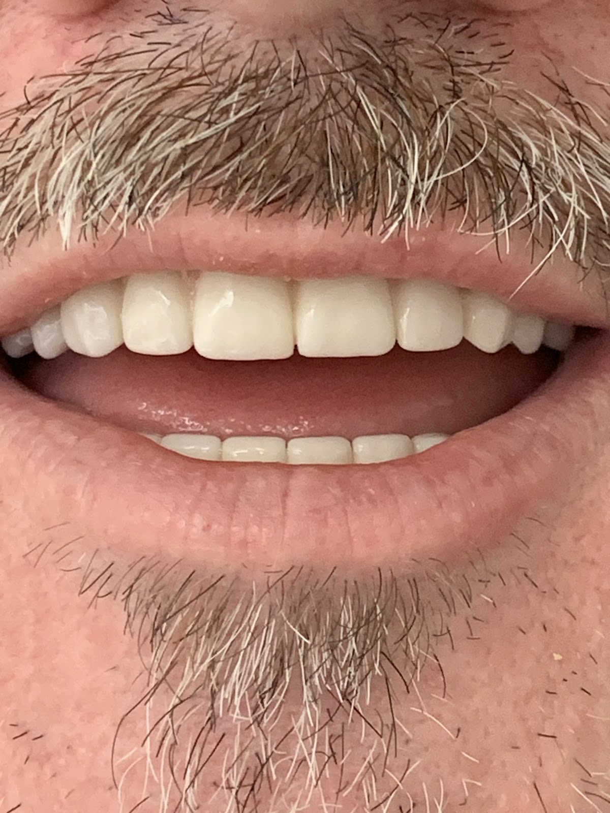 Clearchoice Dental Implant Center - San Jose photo 2