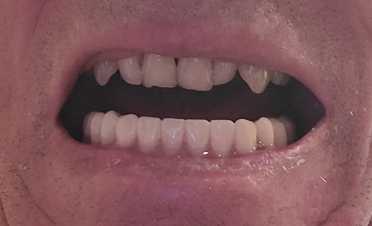 Clearchoice Dental Implant Center - San Jose photo 5
