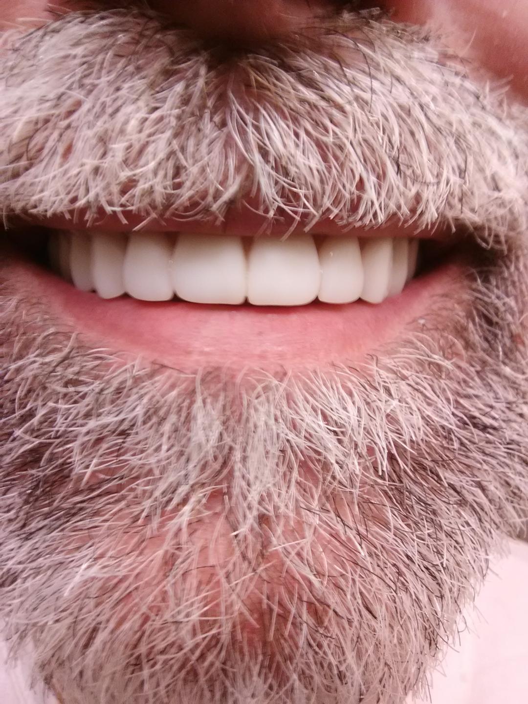 Affordable Dentures & Implants - Harrisonburg photo 2