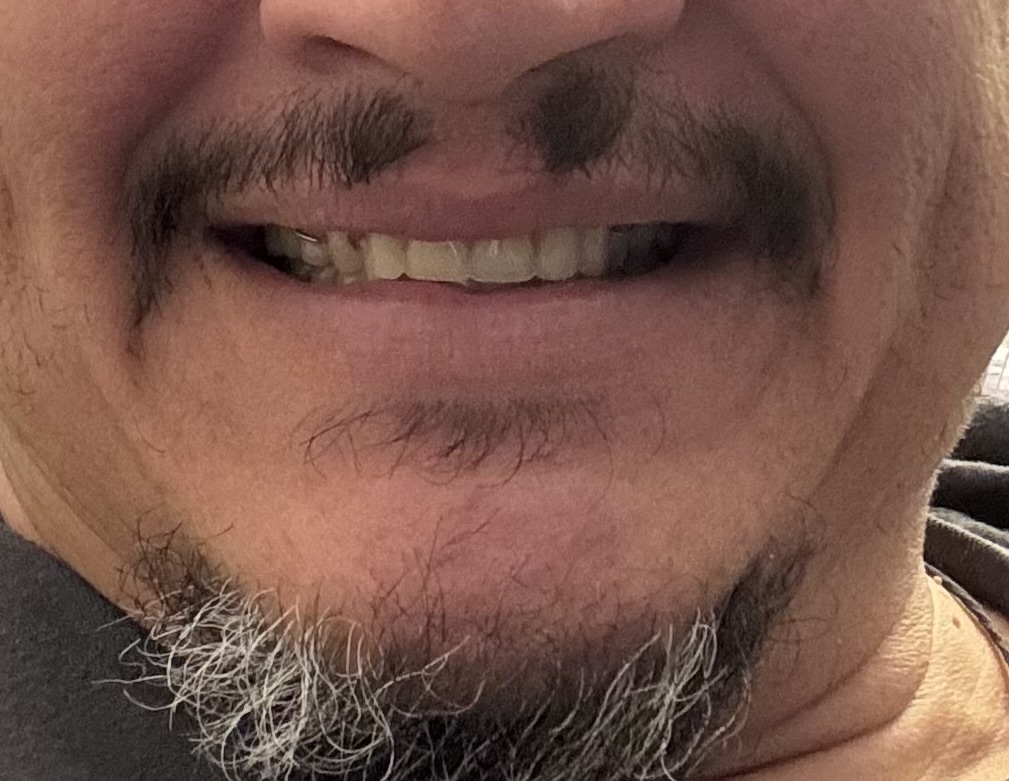 Affordable Dentures & Implants - Harrisonburg photo 5