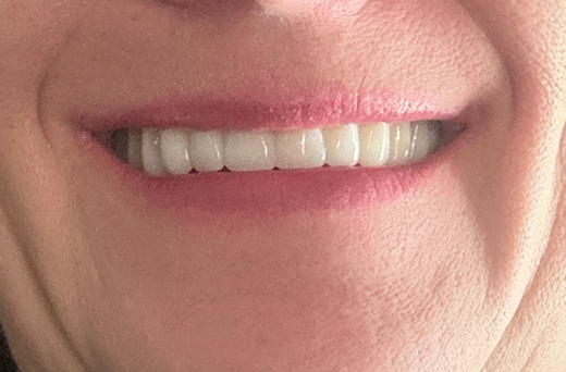 Clearchoice Dental Implant Center - East Lansing photo 3