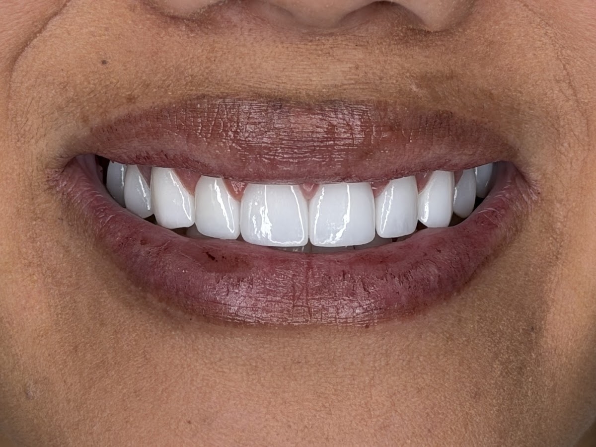 Elite Smiles by Walter Meden DDS photo 2
