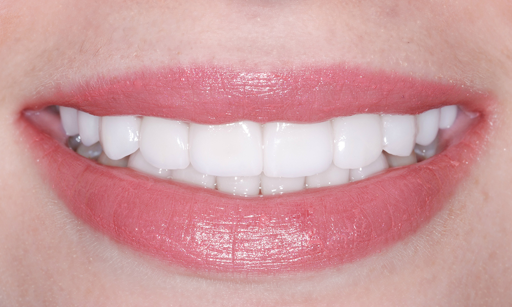 Elite Smiles by Walter Meden DDS photo 3