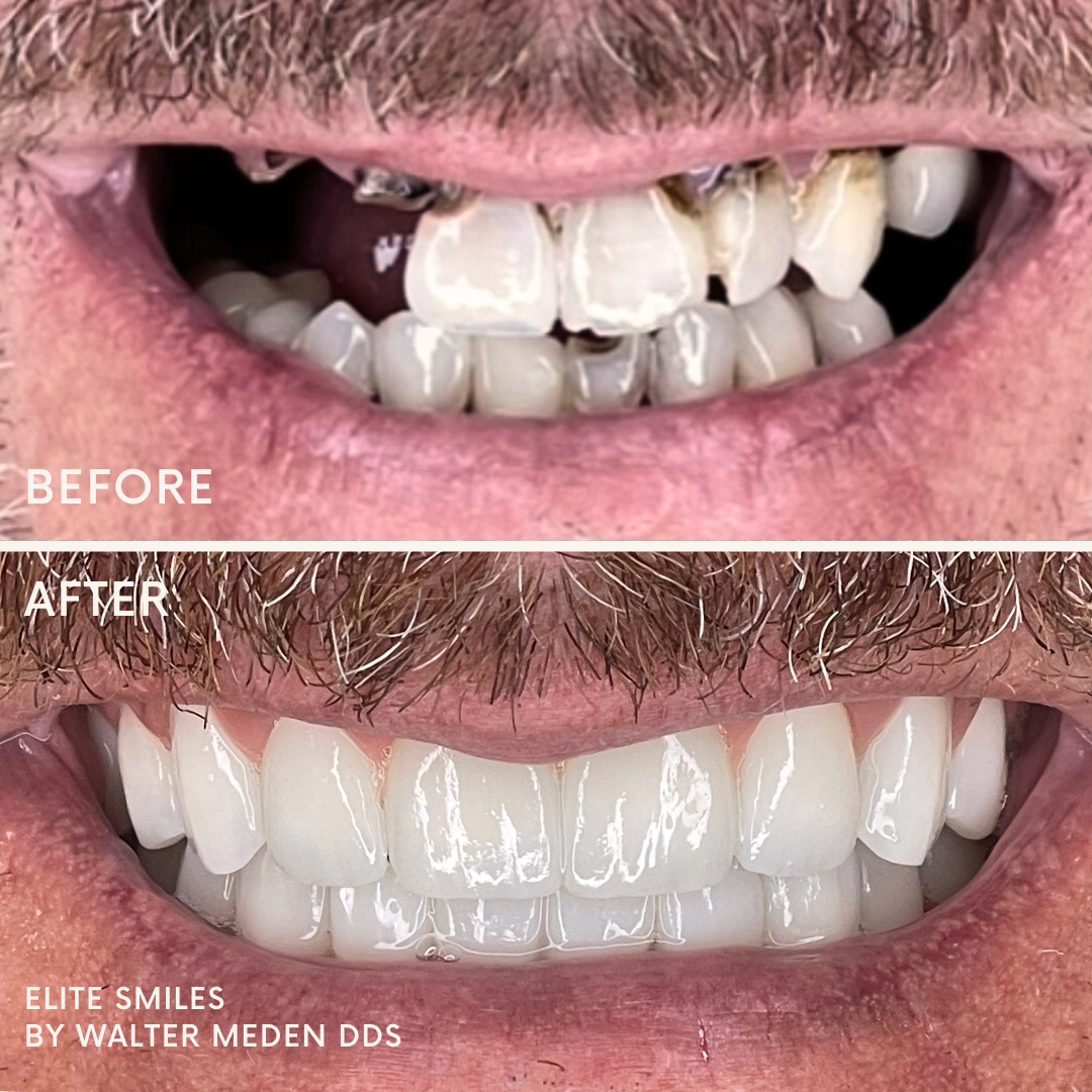 Elite Smiles by Walter Meden DDS photo 6