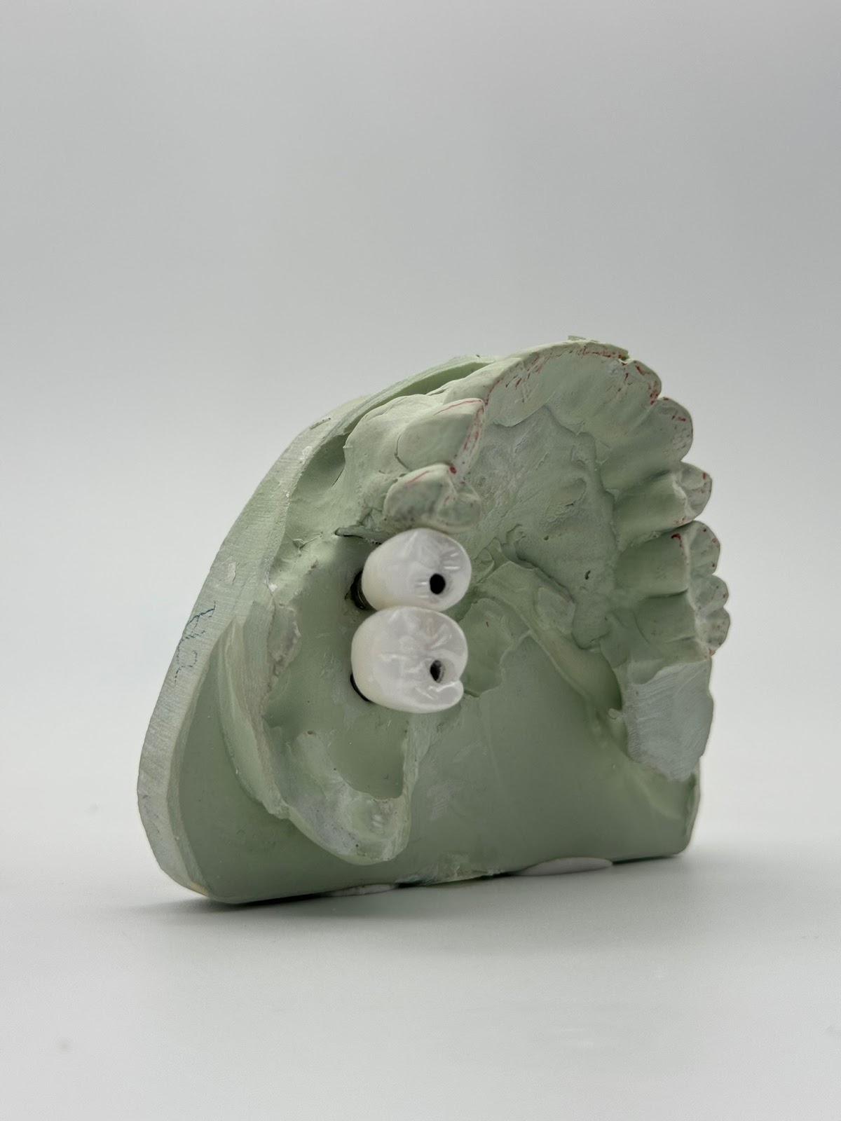 Crown and Denture Solutions photo 5