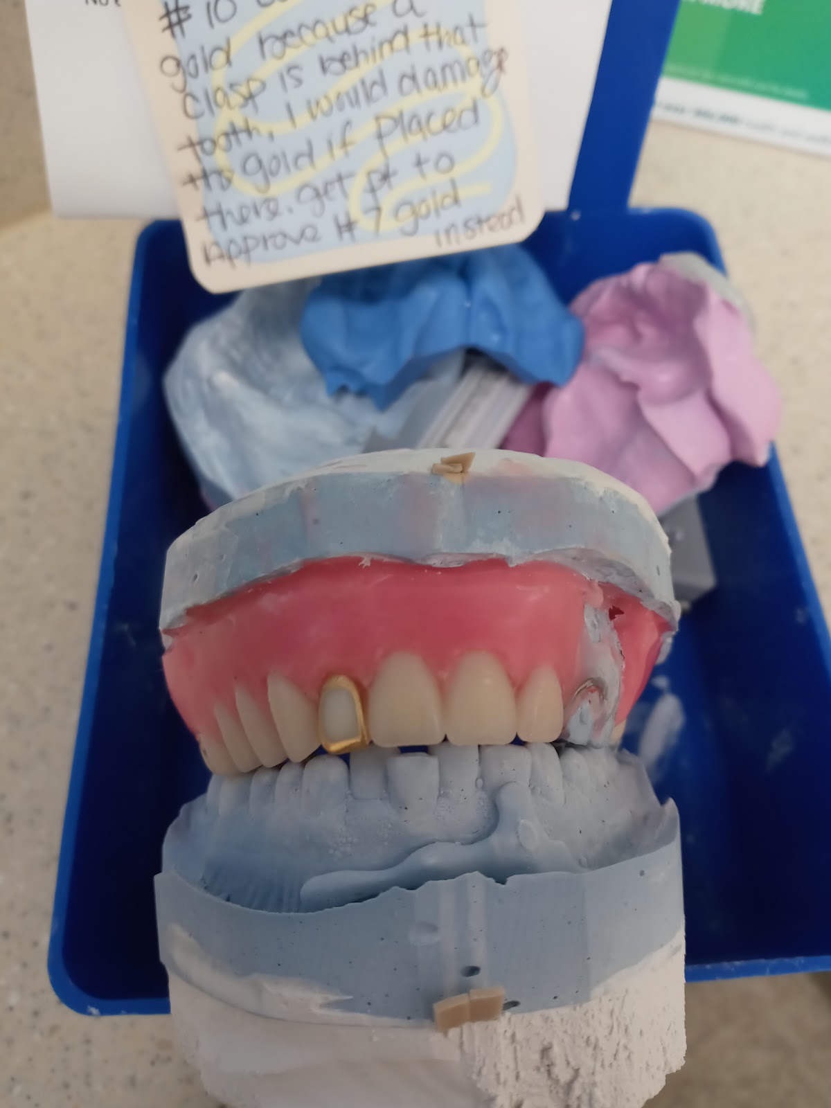 Affordable Dentures & Implants - Birmingham photo 3