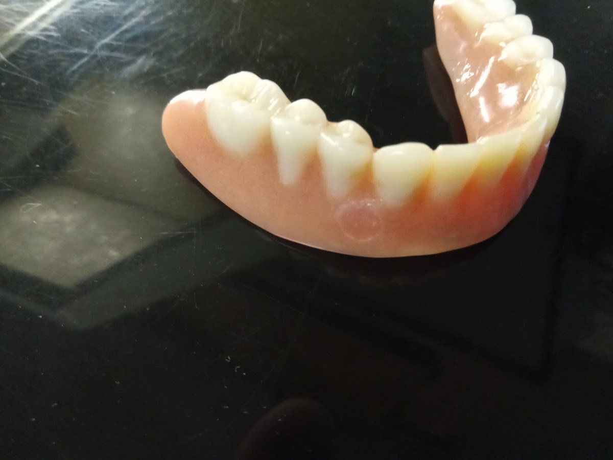 Affordable Dentures & Implants - Birmingham photo 4