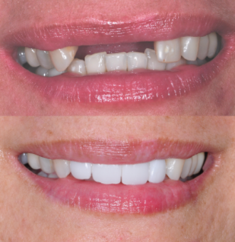Dr. Feras Al Rezk, Daboi, Fagd, Dicoi, Msc, DDS photo 4