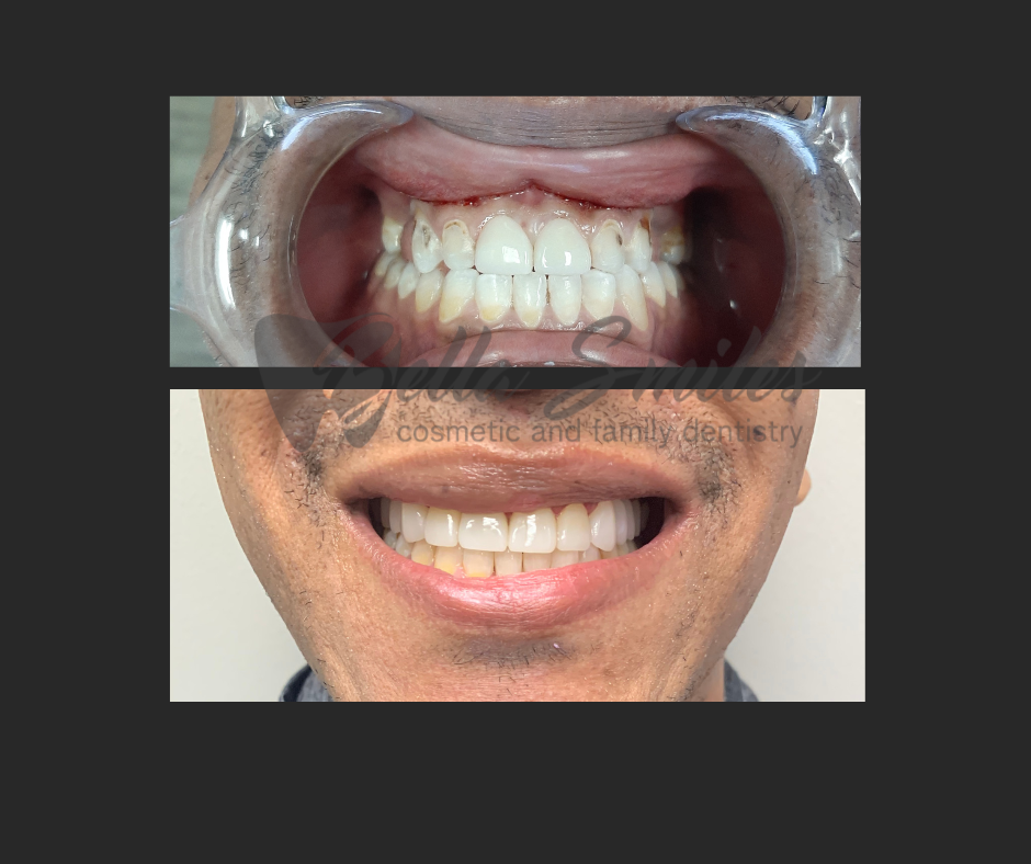 Bella Smiles Cosmetic Dentistry - Sugar Land, Tx photo 2