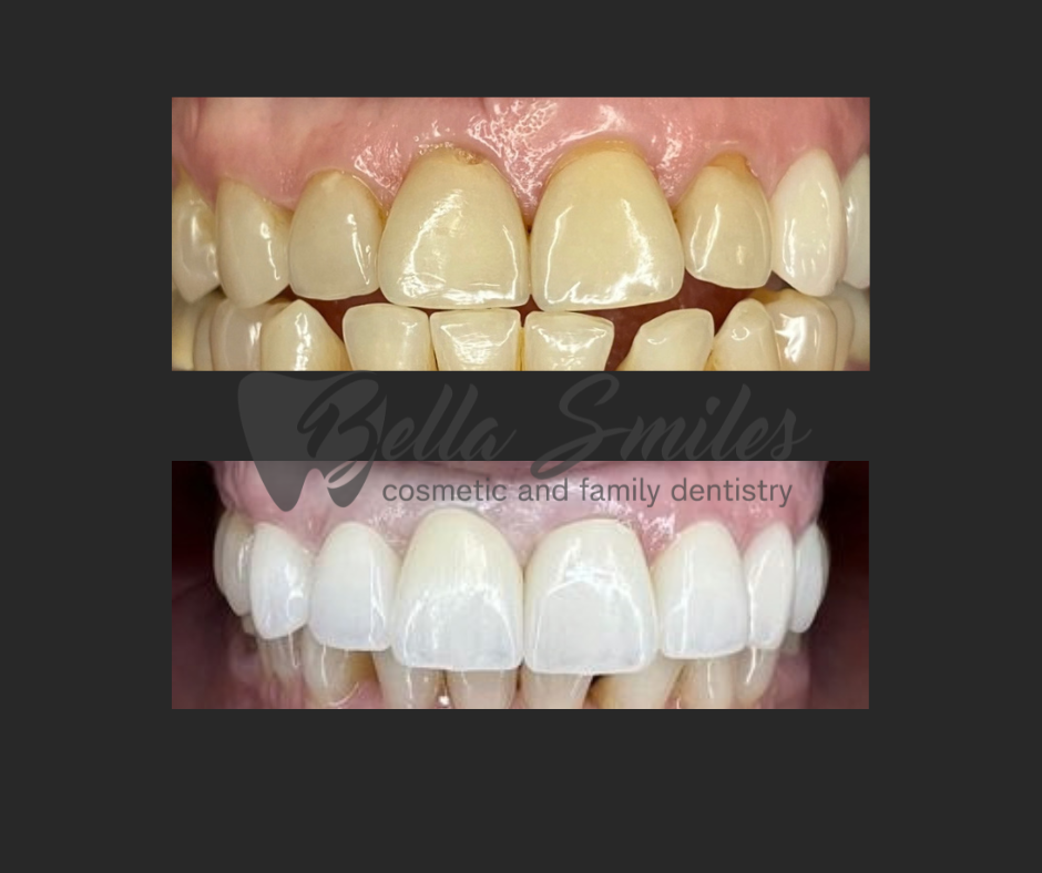 Bella Smiles Cosmetic Dentistry - Sugar Land, Tx photo 5
