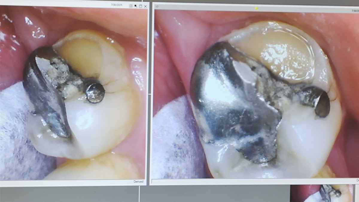 Brewer Family Dentistry photo 3