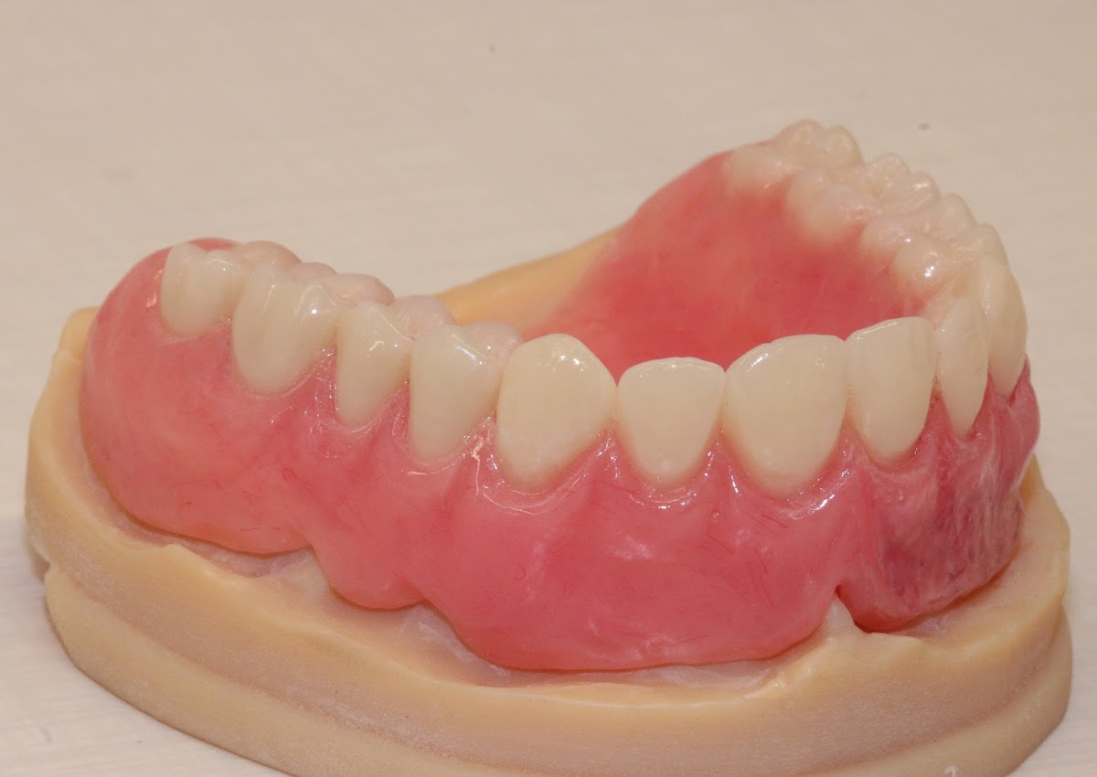 Apex Dental photo 6