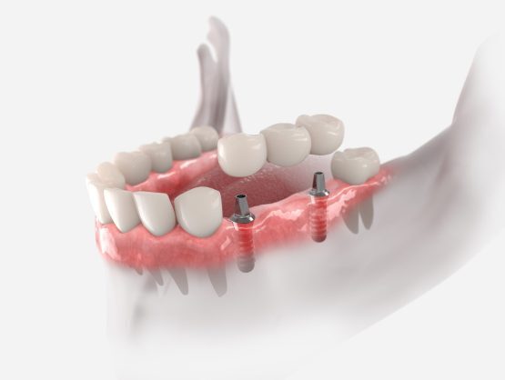 The Dental Implant Place photo 2
