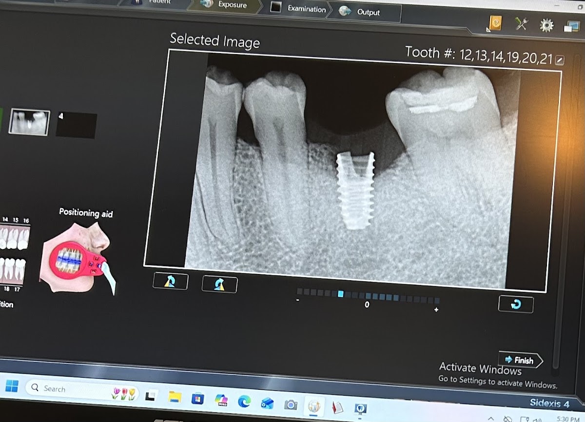 Smile Design: Santa Clarita photo 2