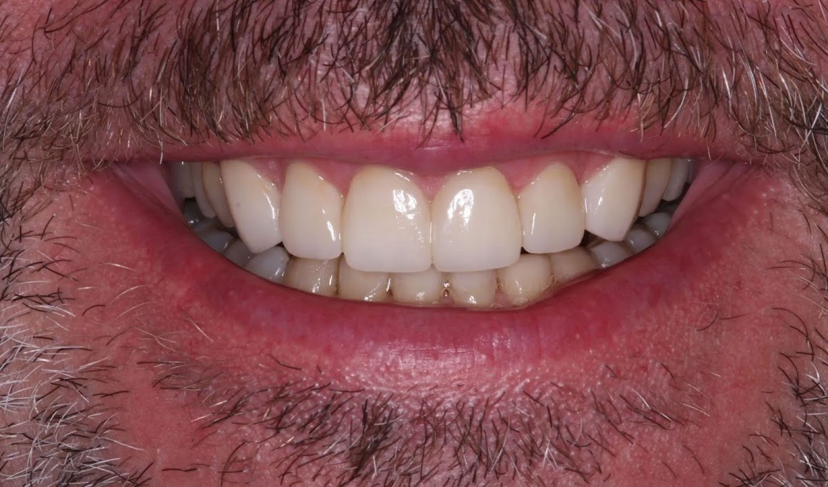 Smilecare Dental photo 2