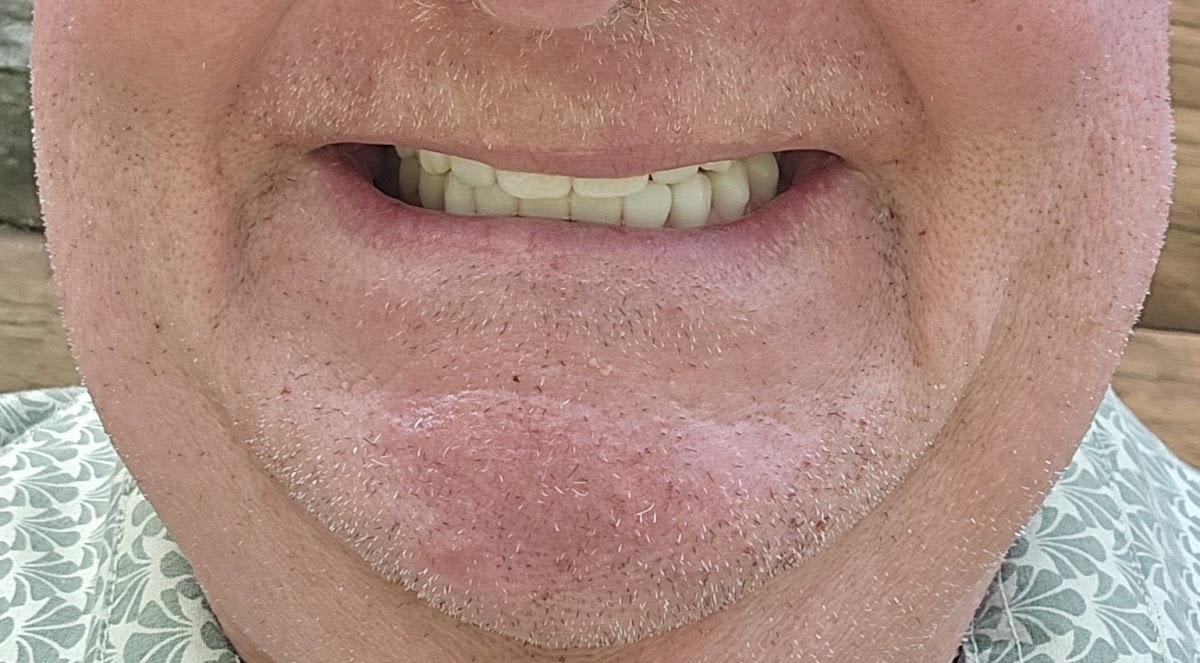 Next Step Smiles Dental Implant Center photo 1