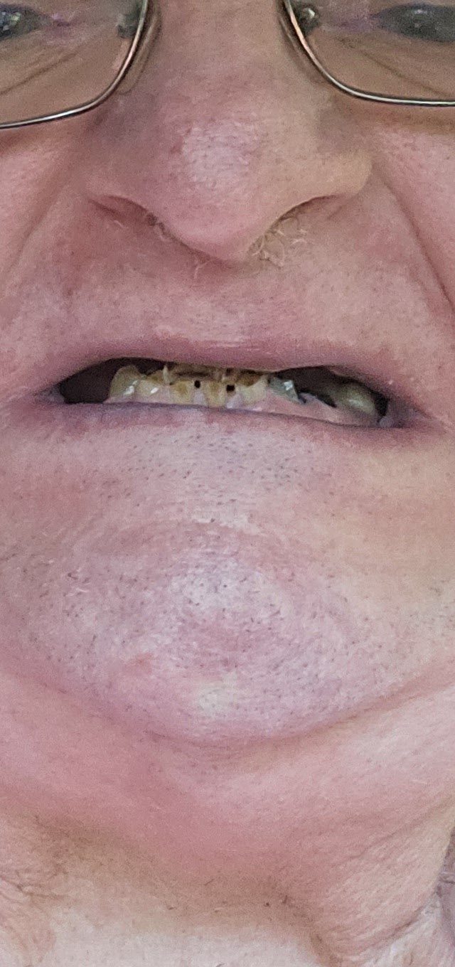 Next Step Smiles Dental Implant Center photo 3