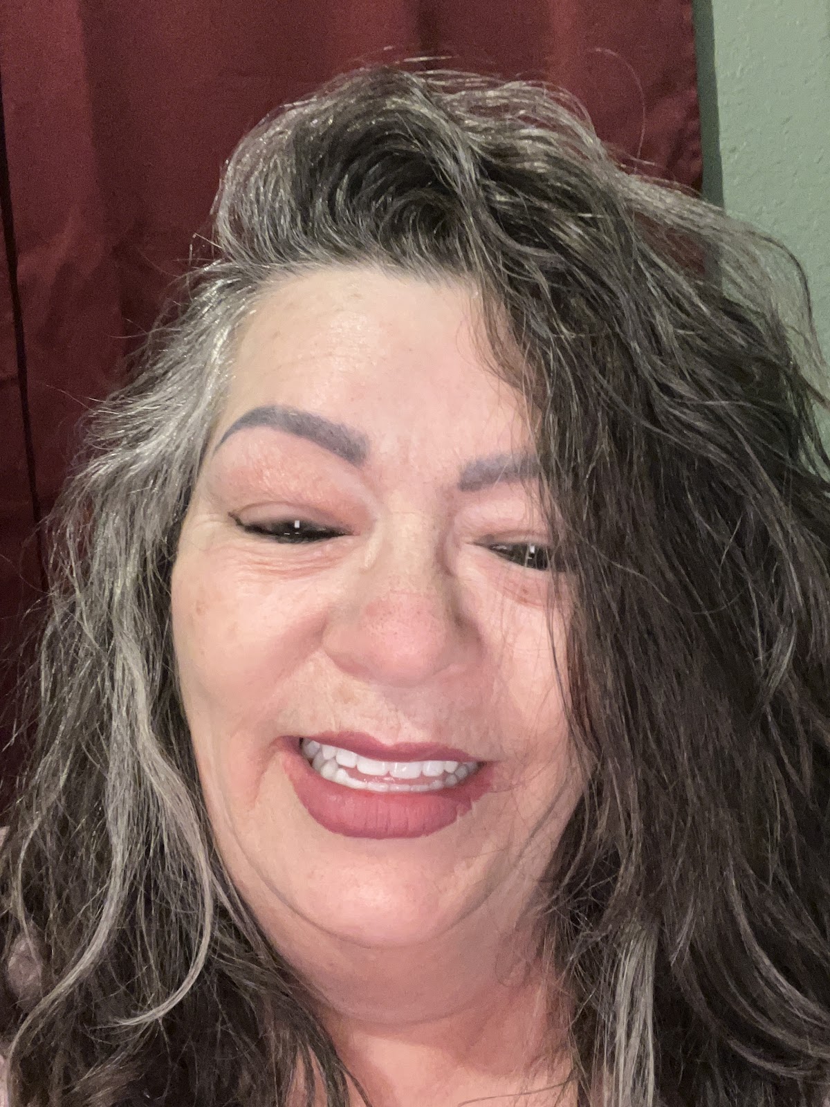 Next Step Smiles Dental Implant Center photo 6