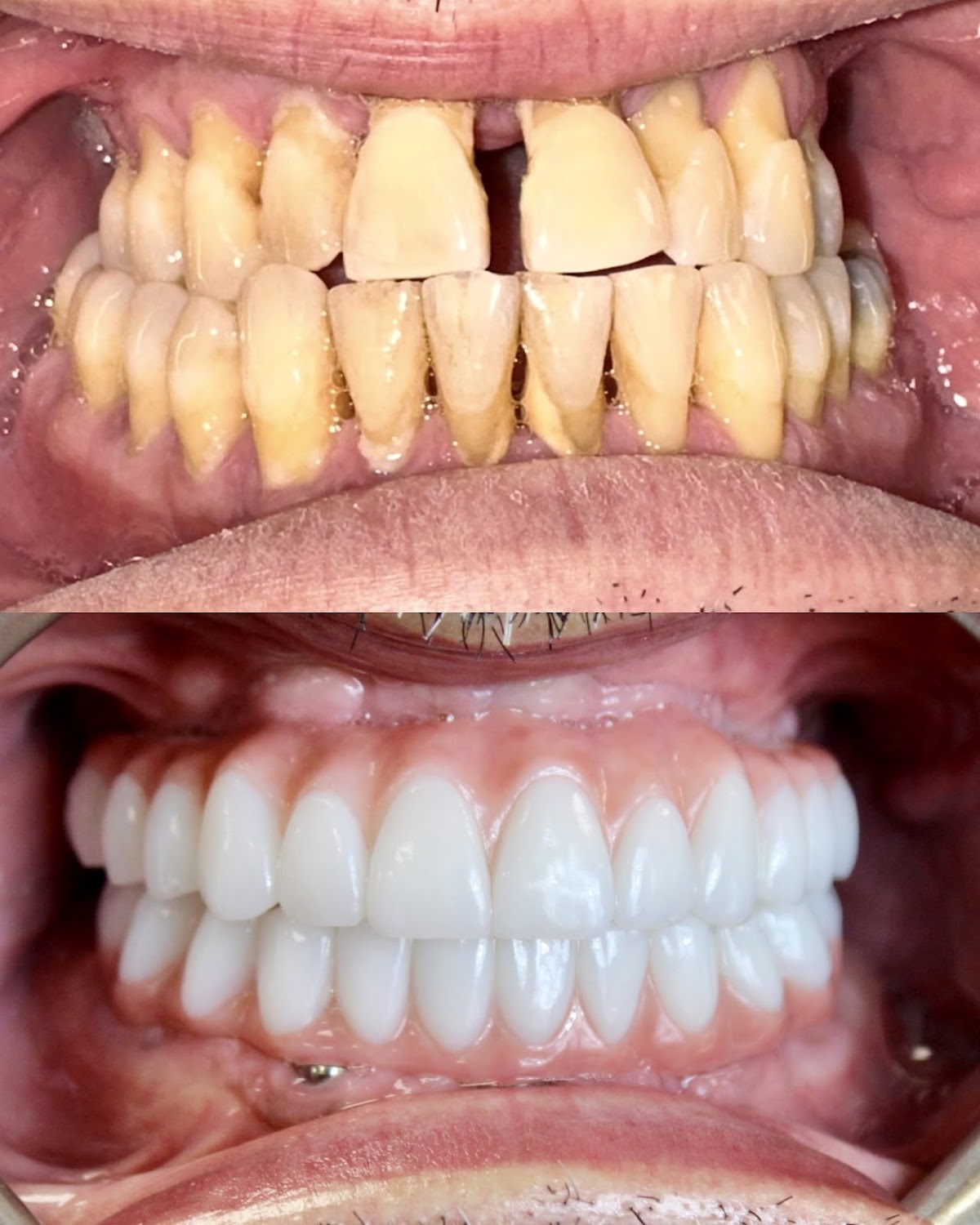 Signature Smiles Dental Implants and Cosmetic Dentistry photo 1