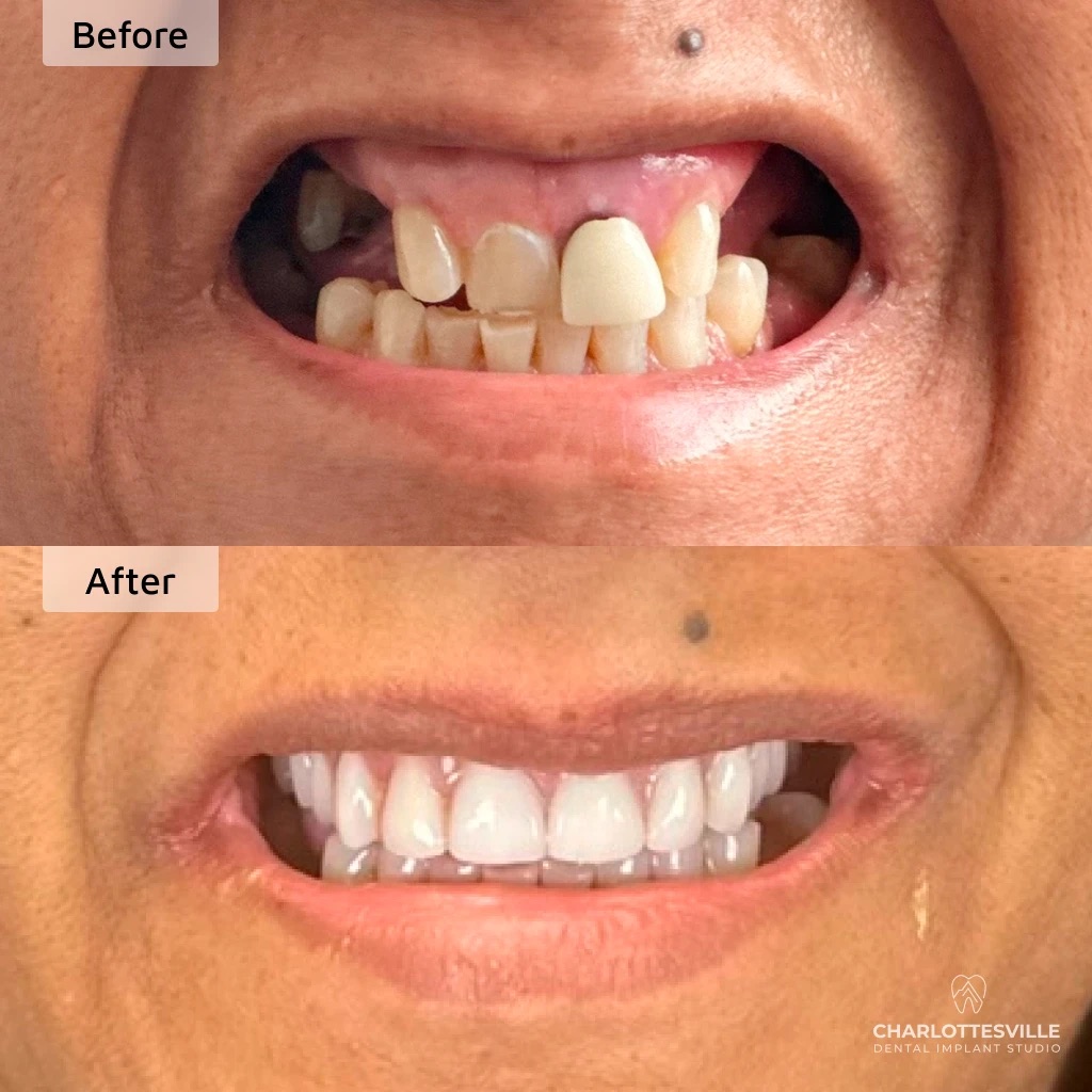 Charlottesville Dental Implant Studio photo 4
