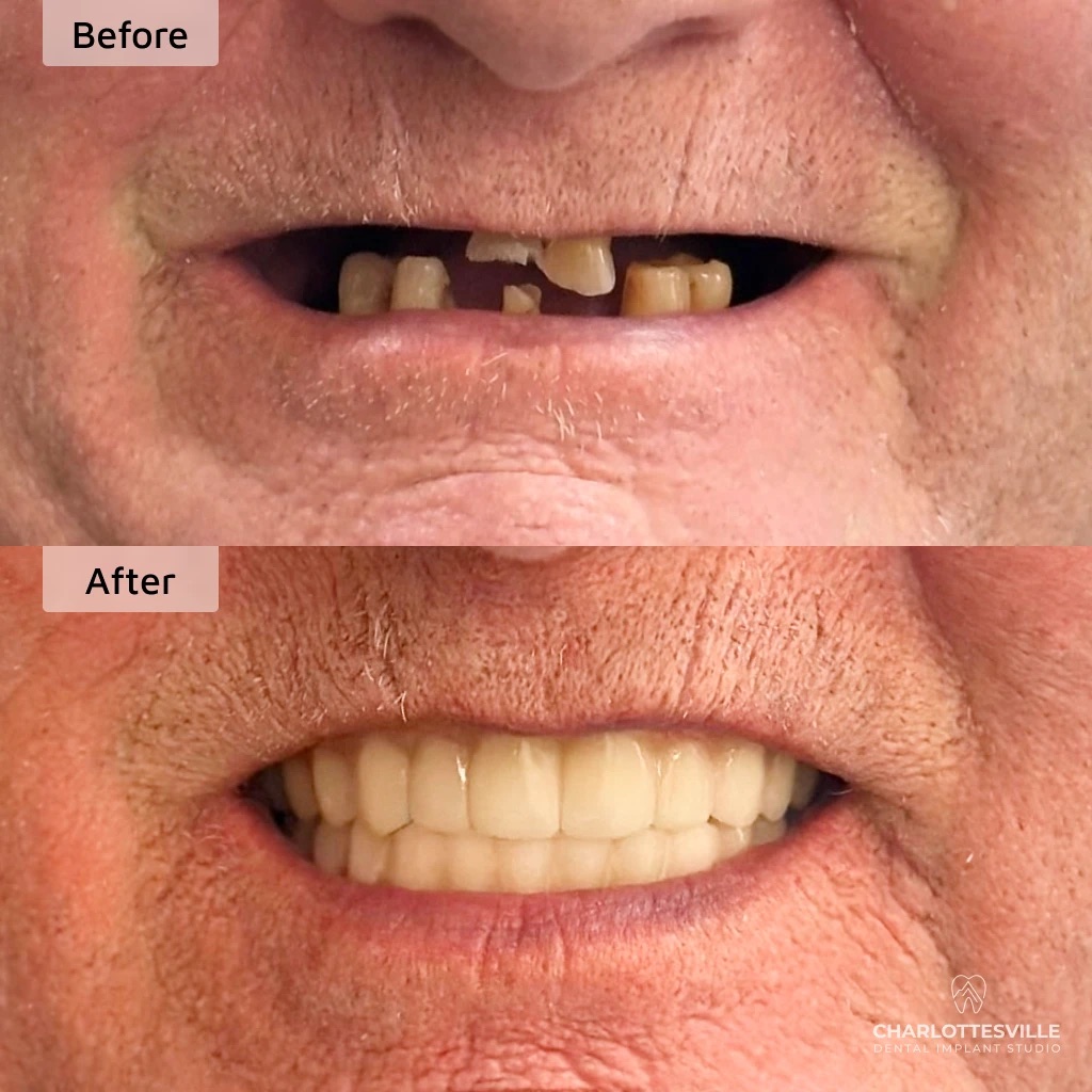 Charlottesville Dental Implant Studio photo 5