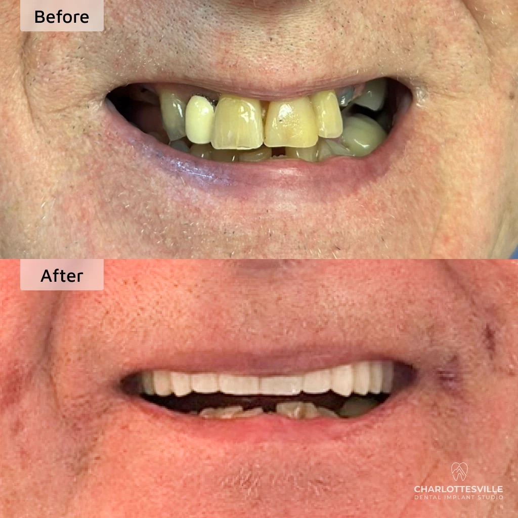 Charlottesville Dental Implant Studio photo 6