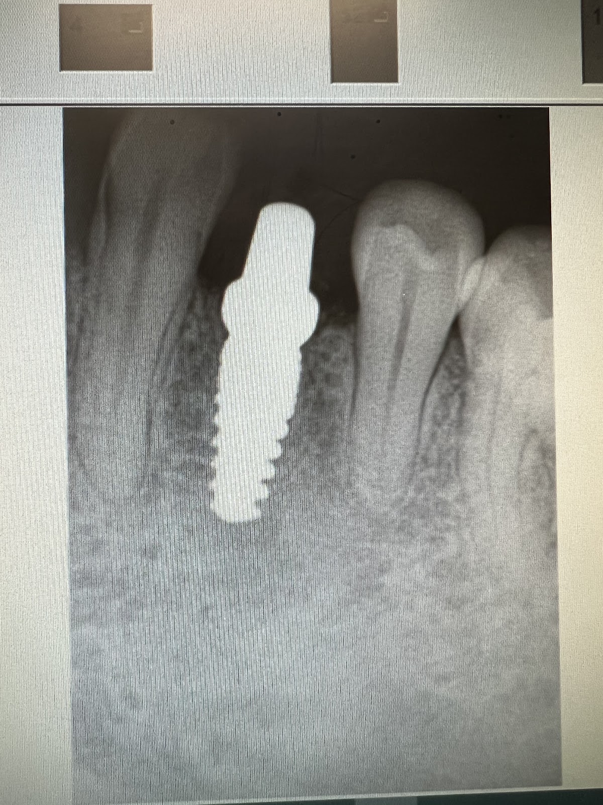 Implantwide Schaumburg photo 2