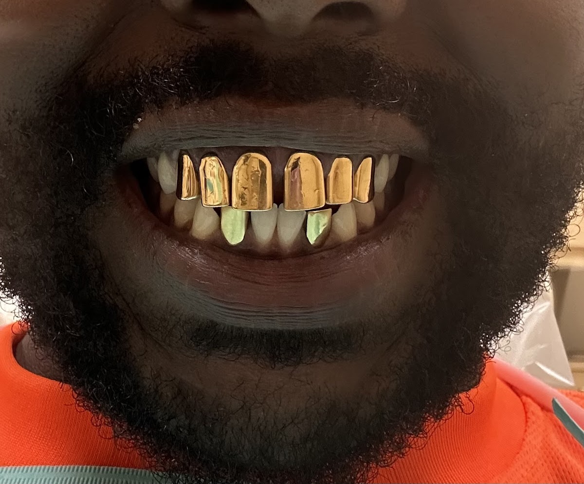 Smile Center Mobile photo 5