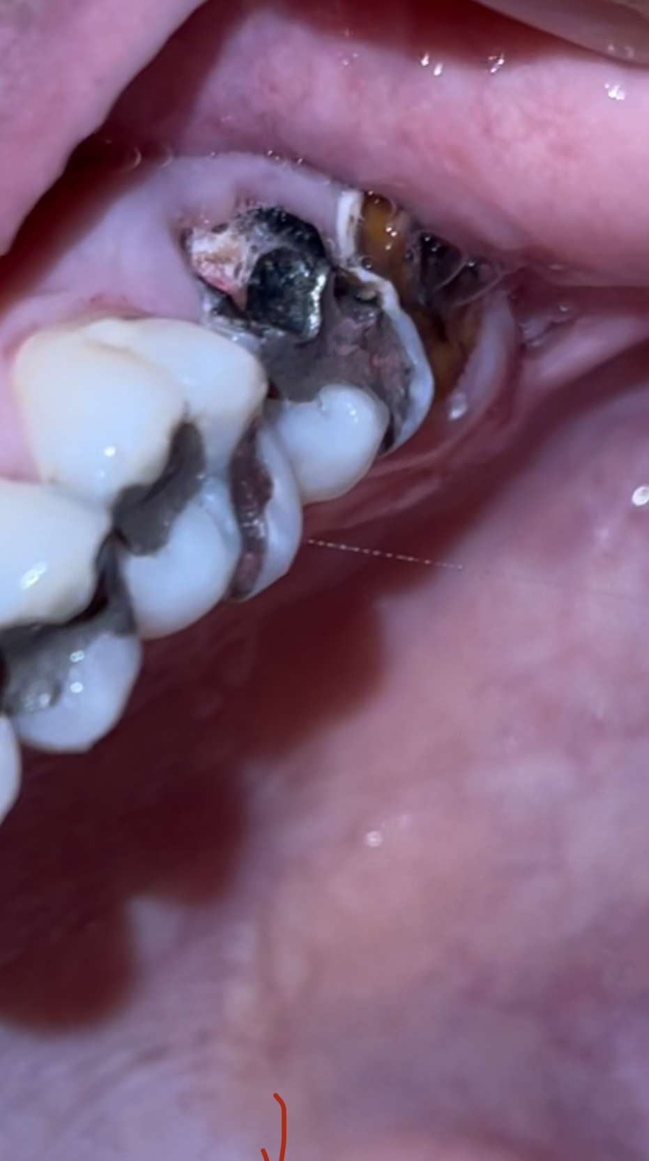 Aspen Dental - Augusta photo 5