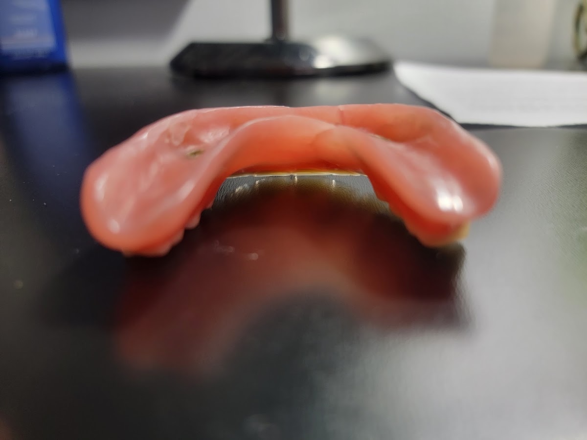 Aspen Dental - Bloomingdale photo 3