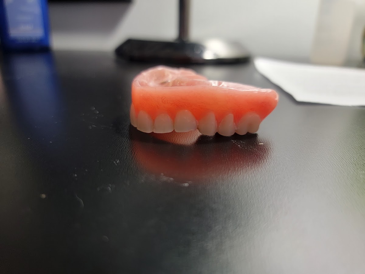 Aspen Dental - Bloomingdale photo 5