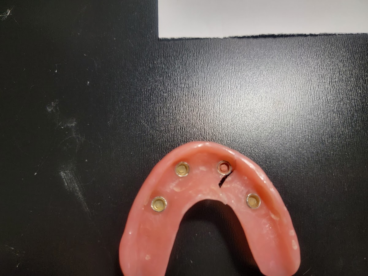 Aspen Dental - Bloomingdale photo 6